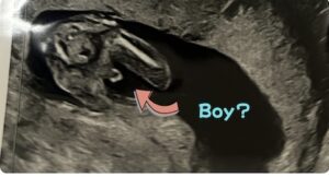 5ヶ月検診のエコー写真、男の子かも👦
